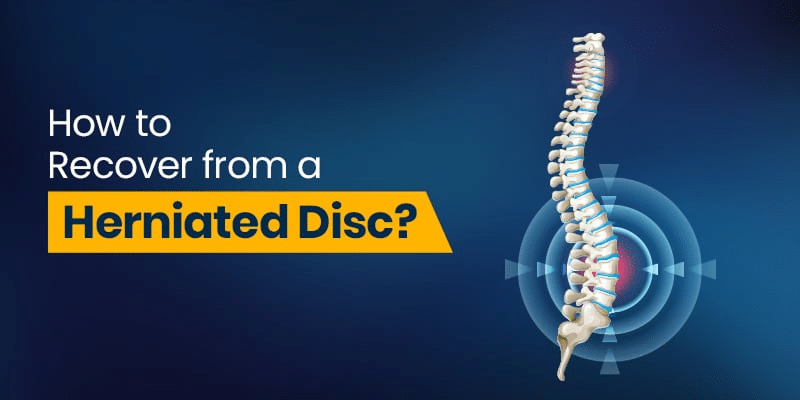 Herniated Disc Recovery Tips